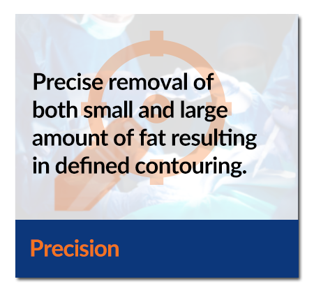 Precision